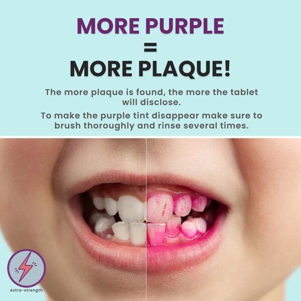 36 Count, Plaque Dental Disclosing Tablets for Kids or Adults, Shows Plaque, Helps Teach Brushing Habits for Clean Teeth, by Fresh Knight, Pack of (1)