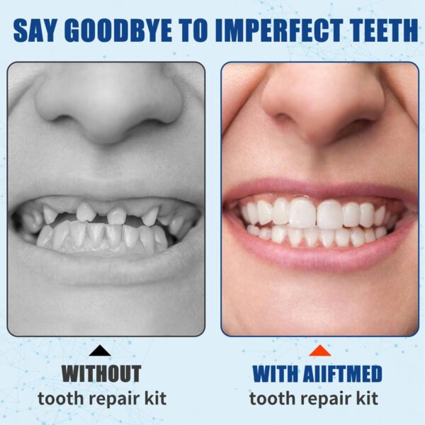 Tooth Repair Kit, Temporary Teeth Replacement Kit, Zinc Oxide Eugenol Cement Dental Kit for Broken Chipped Teeth, Missing Teeth, Crown Fillings & Bridges, Improving Smile 4pcs