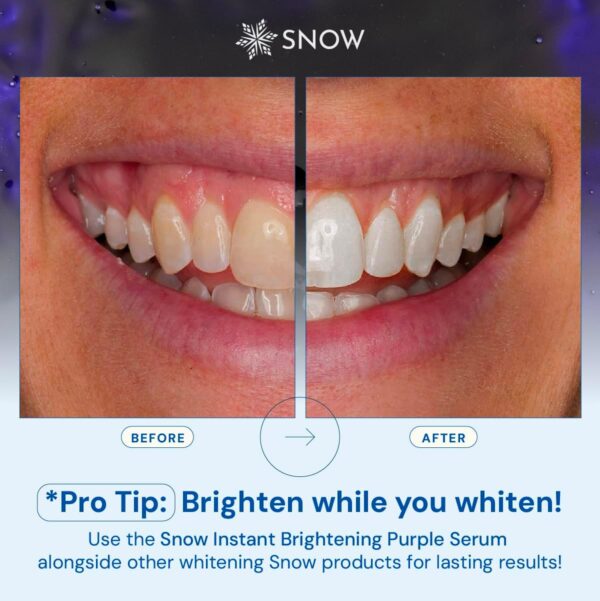 SNOW Teeth Brightening Purple Serum | Gentle & Enamel Safe Instant Brightening for Brighter Smile | Dental Care, Hygiene, & Tooth Care Bright Smile for Events Daily Confidence 2 Month Supply