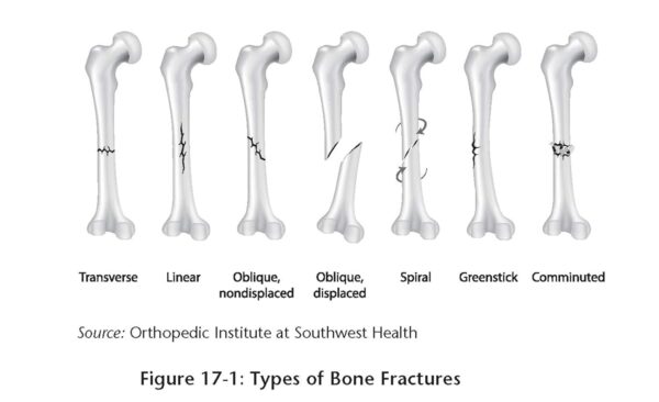 EMT (Emergency Medical Technician) Crash Course with Online Practice Test, 3rd Edition: Get a Passing Score in Less Time (EMT Test Preparation)