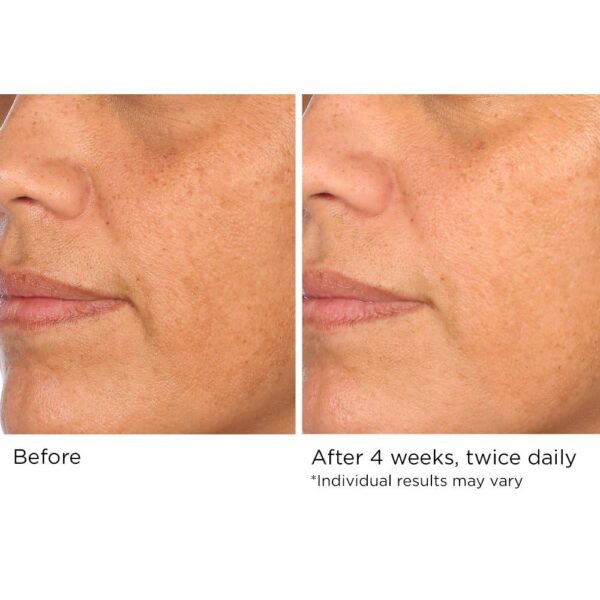 NassifMD Hydro-Screen - Clinical Grade Serum with Premium Ingredients: Ceramides, Retinol, Bakuchiol, Hyaluronic Acid - Anti Aging Treatment