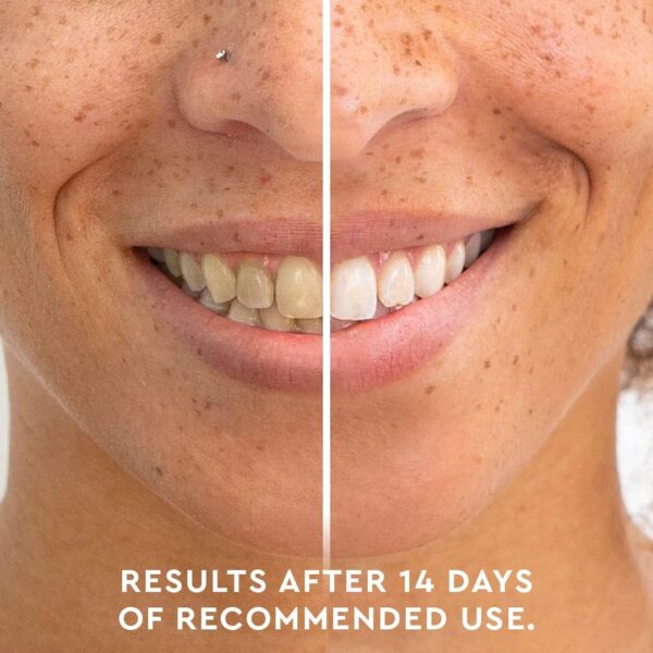 MOON Teeth Whitening Pen, Brush Every Tooth White, On-The-Go Whitener for A Brighter Smile, Gentle on Sensitive Teeth, 30+ Uses, Vegan, Vanilla Mint Flavor