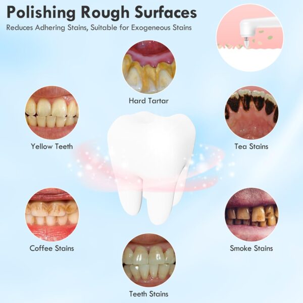 Rechargeable Tooth Polisher Kit for Daily Cleaning, Whitening and Polishing, Electric Dental Teeth Polisher with LED Light, 5 Brush Heads, 5 Speed Modes, Waterproof