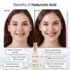 grace & stella Award Winning Hyaluronic Acid Serum (50ml/1.7 fl oz) Hyaluronic Acid Serum for Face - Acido Hialuronico Face Serum for Women - Hydrating Serum Remove Fine Lines, Wrinkles - Anti Aging