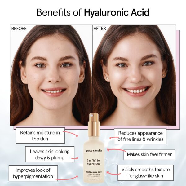 grace & stella Award Winning Hyaluronic Acid Serum (50ml/1.7 fl oz) Hyaluronic Acid Serum for Face - Acido Hialuronico Face Serum for Women - Hydrating Serum Remove Fine Lines, Wrinkles - Anti Aging