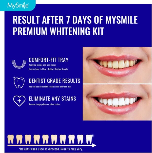 MySmile 7 Treatments Prefilled Teeth Whitening Trays Kit with12% Hydrogen Peroxide Teeth whitening Gel for Sensitive Teeth, Fast-Result Vegan Teeth Whitener Tooth Stain Remover, Mint Flavor