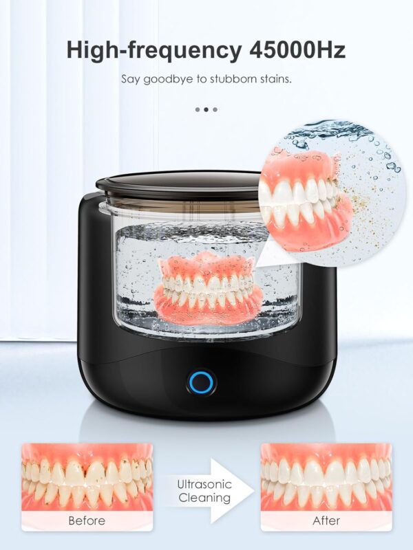 Retainer Cleaning Machine with 45 KHz Portable Professional Denture Cleaner for Retainer, Dental