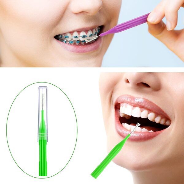 Patelai 100 Pieces Braces Brush for Cleaner Interdental Brush Toothpick Dental Flossing Head Oral Hygiene Flosser Tooth Cleaning Tool (Stylish Colors)