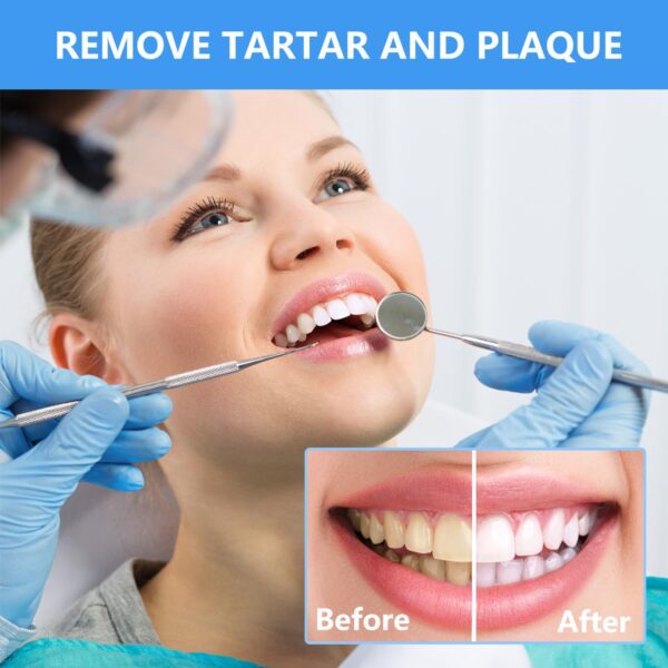 7196bAUv3vL._SL1500_.jpg Dental Tools, Professional Plaque Remover Teeth Cleaning Tool Kit, Stainless Steel Dental Pick Tartar Scraper Tooth Cleaner, Oral Care Hygiene Set for Dentist Personal Pets with Storage Box