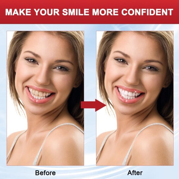 SP-8 Probiotic Toothpaste, SP8 Toothpaste Fresh Breath, Deep Cleaning Care Toothpaste (02)