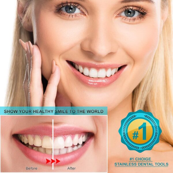 Dental Tools, 6 Pack Teeth Cleaning Tools Stainless Steel Dental Scraper, Pick Hygiene Set with Mouth Mirror, Tweezer for Dentist, Personal Using, Pets - Teeth Cleaning Kit - Dental Cleaning Kit