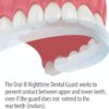 Oral-B Nighttime Dental Guard, Less Than 3-Minutes for Custom Teeth Grinding Protection with Scope Mint Flavor