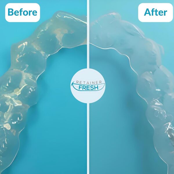 Retainer Cleaner Tablets Invisalign Cleaner, Mouth Guard Cleaner, Night Guard Cleaner, Denture Cleaning, Tablets for Ultrasonic Cleaner. 36 Tablets - 1 Month Supply by Retainer Fresh