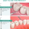 Professional Dental Scraper Tool - Dentist Pick, Medical Stainless Steel, Dental Tarter Scraper for Tooth Stains Remover, Dentist Home Use Tools