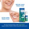 Aligner Fresh Foam Whitening & Retainer Cleaning Foam for Invisalign, ClearCorrect, Essix, Vivera, Mouth Guards, Night Guards, Veneers, Whitens Teeth, Freshens Breath, 3% Hydrogen Peroxide, 1 Pk, Mint
