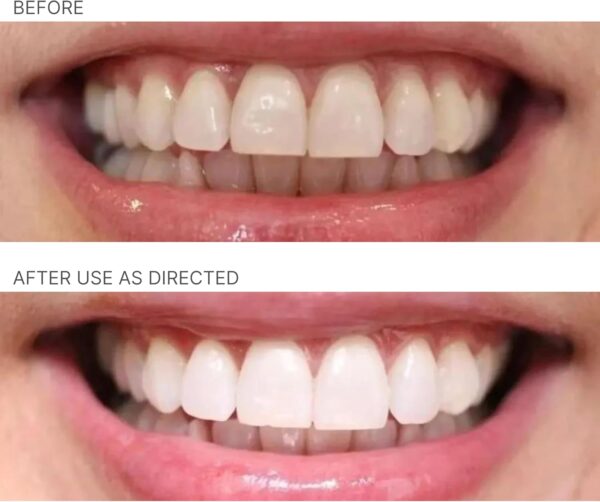 Nu Skin AP 24 Whitening Fluoride Toothpaste | 4oz | Brightens and Whitens Teeth | Helps Prevent Dental Cavities | Gentle Vanilla Mint Formula | 2 Pack