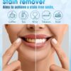 Teeth Whitening Kit for Sensitive Tooth: 35% Carbamide Peroxide White Gel Pens LED Light Whitener with Dental Mouth Trays Professional Bright Brace Oral Care Product System for Home Work Travel