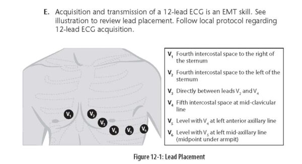 EMT (Emergency Medical Technician) Crash Course with Online Practice Test, 3rd Edition: Get a Passing Score in Less Time (EMT Test Preparation)