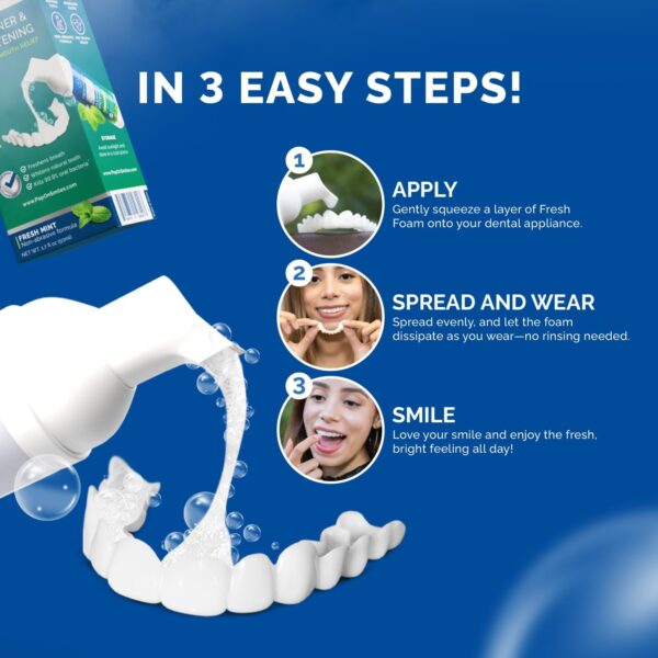 Aligner Fresh Foam Whitening & Retainer Cleaning Foam for Invisalign, ClearCorrect, Essix, Vivera, Mouth Guards, Night Guards, Veneers, Whitens Teeth, Freshens Breath, 3% Hydrogen Peroxide, 1 Pk, Mint