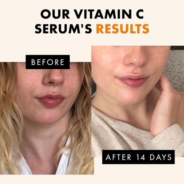 Vitamin C Face Serum - Dark Spot Serum, Vit C Serum with Hyaluronic Acid, Ferulic Acid, & Vit E - Anti Aging and Skin Brightening Serum, Pure Vitamin C Serum Skin Care 30 ml