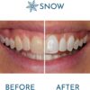 Snow Extra Strength Teeth Whitening - Teeth Whitening Pen, at Home Stick Refills, Tooth Serum Wand for & Oral Care, Easy to Use Whitener Stick - Pack of 1