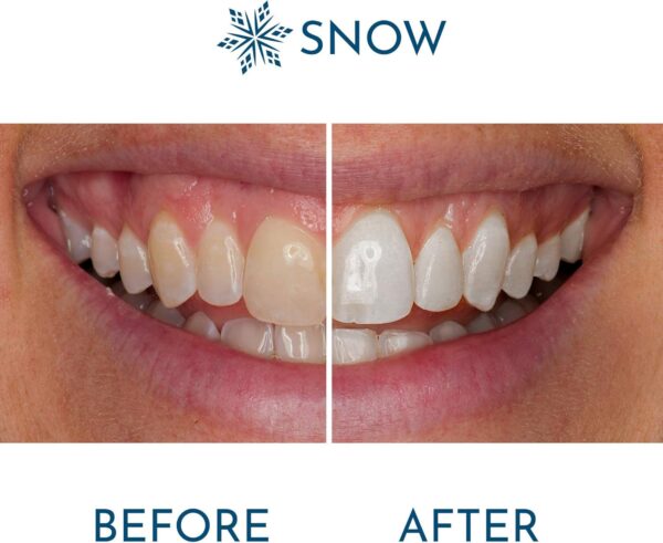 Snow Extra Strength Teeth Whitening - Teeth Whitening Pen, at Home Stick Refills, Tooth Serum Wand for & Oral Care, Easy to Use Whitener Stick - Pack of 1