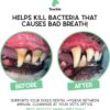 Barkle Dog Teeth Cleaning Gel | Best Dog Tooth Brushing Kit | Vet Reviewed to Eliminate Plaque, Tartar & Bad Breath | Toothpaste Replacement | Dog Breath Freshener | Free Finger Brush (Mint - 60 Days)