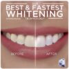 Crest 3D Whitestrips with Light, Whitestrips 3D White, Teeth Whitening Strip Kit, 20 Strips (10 Count Pack), Crest Teeth Whitening Strips, Teeth Whitening Kit