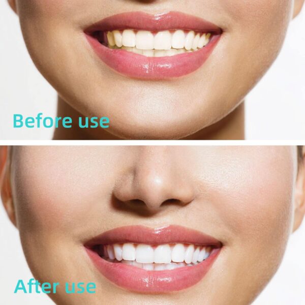 GOUWEIBA 100 pcs Braces Brush Disposable Interdental Brush Toothpick Dental Tooth Flossing Head Oral Dental Hygiene Flosser Dental Hygiene Flosser Tooth Cleaning Tools Oral Flossing Head (Blue+Red)