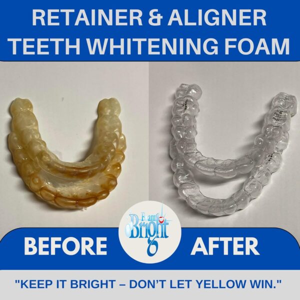 Aligner Cleaner & Retainer Cleaner Foam Bright, Teeth Whitening Foam, Great for Invisalign, Candid, Byte, Night Guard, Mouth Guard, Dentures, Whitener, Toothpaste & Braces Cleaner, Peroxide Free
