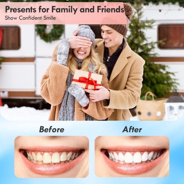 Rechargeable Tooth Polisher Kit for Daily Cleaning, Whitening and Polishing, Electric Dental Teeth Polisher with LED Light, 5 Brush Heads, 5 Speed Modes, Waterproof