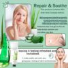 99% Purity Aloe Vera Gel - Hydrating Aloe Vera Gel for Face and Skin,No Sticky Moisturizing Aloe Gel(5 pcs)