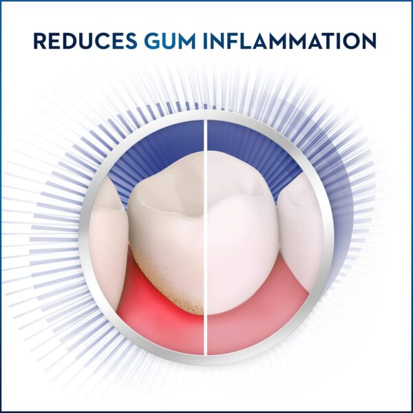 Crest Pro-Health Gum Care Mouthwash, Cool Wintergreen, CPC Antigingivitis/Antiplaque Oral Rinse 1L (33.8 fl oz), Pack of 2, Crest Mouthwash, Mouthwash for Adults, Alcohol Free Mouthwash