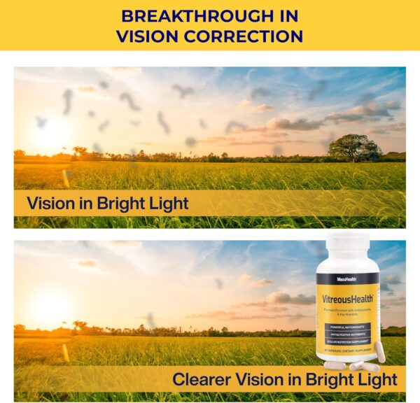 Macuhealth VitreousHealth Evidence-Based Eye Supplement - 90 Capsules
