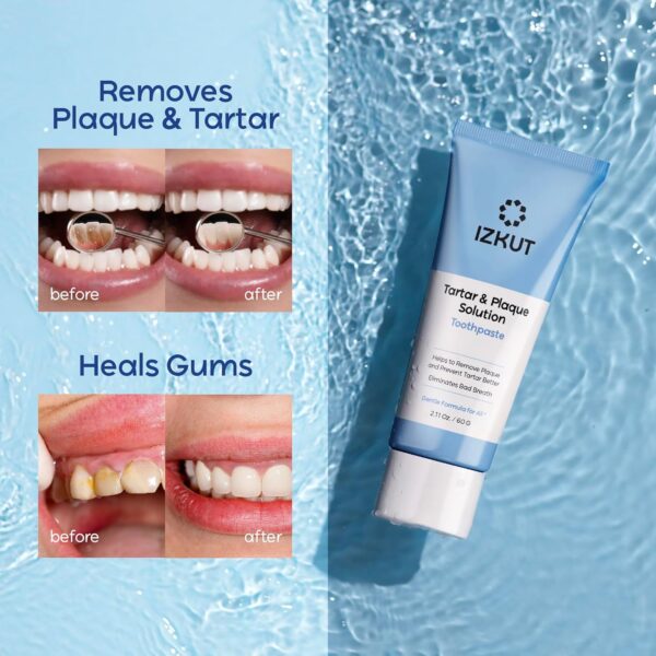 Tartar Control Toothpaste for Tartar Removal: Plaque Remover - Plaque Remover for Teeth - Tartar Remover for Teeth - Hard Plaque Remover - Plaque Toothpaste - Removes Plaque, Prevents & Reduces Tartar