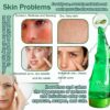 99% Purity Aloe Vera Gel - Hydrating Aloe Vera Gel for Face and Skin,No Sticky Moisturizing Aloe Gel(5 pcs)